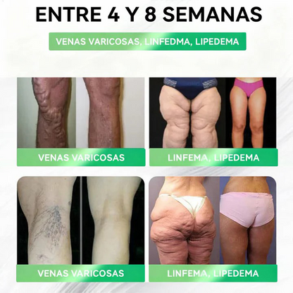 𝑺𝒐𝒍𝒖𝒄𝒊𝒐́𝒏 𝒐𝒓𝒂𝒍 𝑽𝒊𝒕𝒂𝒍𝒖𝒏𝒂𝒉𝒆𝒂𝒍𝒕𝒉® 𝑮𝑳𝑷-1 8 𝒆𝒏 1 𝑭𝒊𝒕 & 𝑽𝒊𝒕𝒂𝒍 (𝒔𝒐𝒍𝒐 𝒖𝒏𝒂 𝒗𝒆𝒛 𝒂𝒍 𝒅𝒊́𝒂, 𝒄𝒂𝒎𝒃𝒊𝒐𝒔 𝒗𝒊𝒔𝒊𝒃𝒍𝒆𝒔 𝒆𝒏 7 𝒅𝒊́𝒂𝒔) √ 𝑷𝒂𝒓𝒂 𝒐𝒃𝒆𝒔𝒊𝒅𝒂𝒅, 𝒔𝒂𝒍𝒖𝒅 𝒄𝒂𝒓𝒅𝒊𝒐𝒗𝒂𝒔𝒄𝒖𝒍𝒂𝒓, 𝒅𝒊𝒂𝒃𝒆𝒕𝒆𝒔, 𝒂𝒑𝒏𝒆𝒂 𝒅𝒆𝒍 𝒔𝒖𝒆𝒏̃𝒐, 𝒔𝒂𝒍𝒖𝒅 𝒊𝒏𝒕𝒆𝒔𝒕𝒊𝒏𝒂𝒍, 𝒑𝒓𝒐𝒃𝒍𝒆𝒎𝒂𝒔 𝒂𝒓𝒕𝒊𝒄𝒖𝒍𝒂𝒓𝒆𝒔 𝒚 𝒎𝒂́𝒔-CU