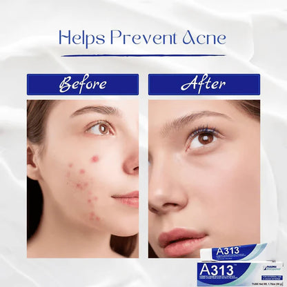 ✨ Get Clear, Radiant Skin Fast - 70% OFF- ✨ Ultimate A313 + HA Skincare Duo - For All Ages-CU