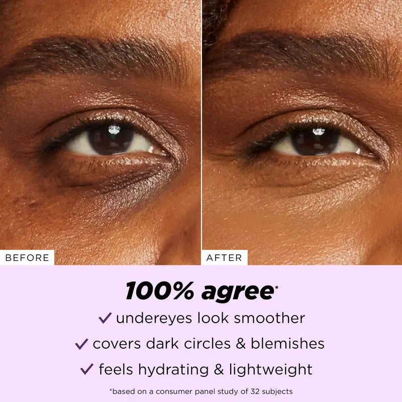 ✨ Get 54% OFF ✨ creamy concealer - eye cream in a bottle-CU